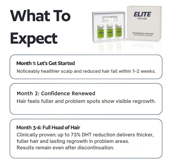 EliteInfuse™ Hair Regrowth System - Elite Infuse