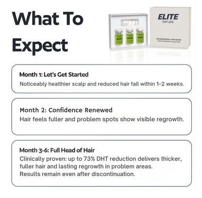 EliteInfuse™ Hair Regrowth System - Elite Infuse